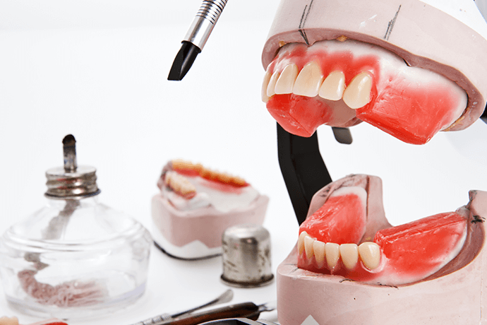 入れ歯制作のポイント